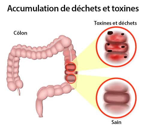 accumulation déchets et toxines intestin